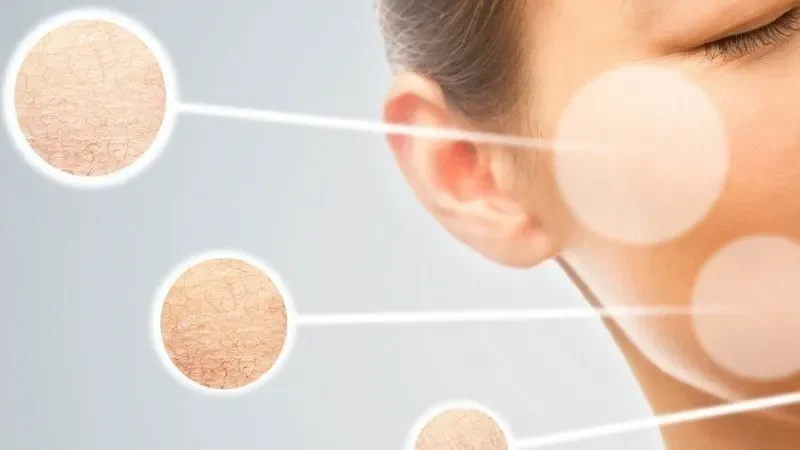 "Nhận Diện" Làn Da Khô: Những Dấu Hiệu Cần Biết