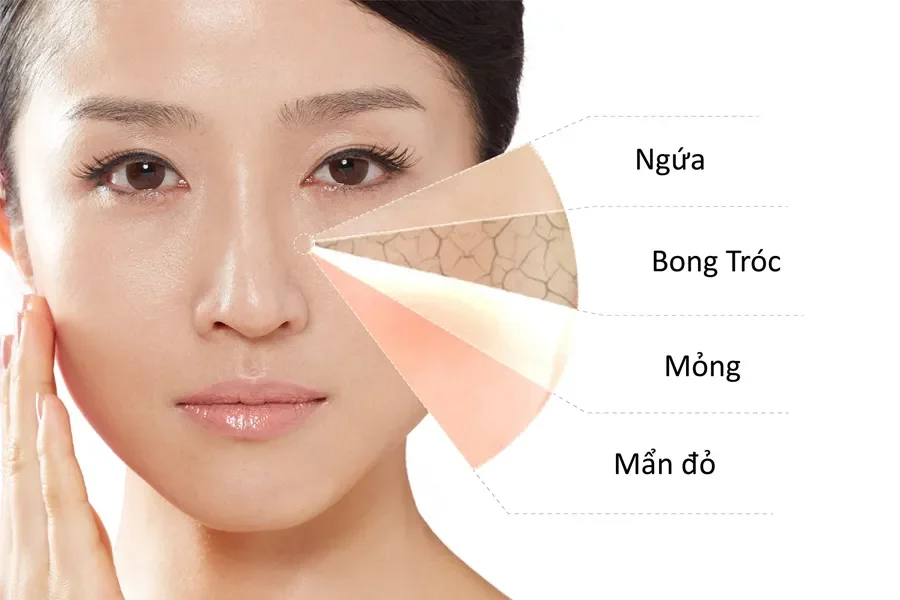 Cân Nhắc Độ Tuổi và Vấn Đề Da Cụ Thể