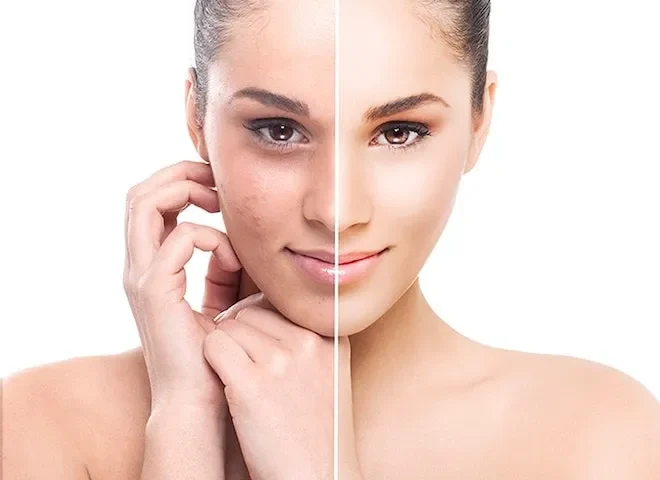 Cách Phục Hồi Da Bị Tổn Thương Do Dùng Mỹ Phẩm Kém Chất Lượng